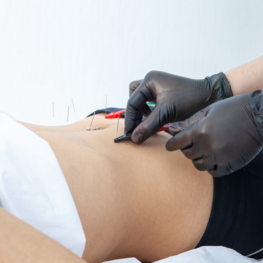 ΒΕΛΟΝΙΣΜΟΣ: ΑΠΑΛΛΑΓΕΙΤΕ ΑΠΟ ΠΕΡΙΤΤΑ ΚΙΛΑ ΚΑΙ ΤΟΠΙΚΟ ΠΑΧΟΣ ΧΩΡΙΣ ΦΑΡΜΑΚΑ